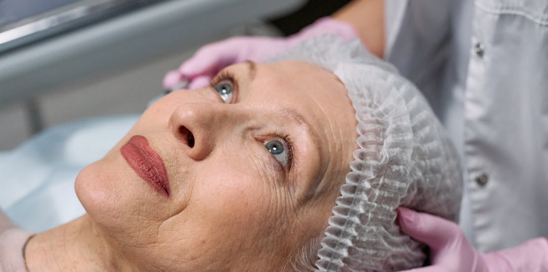 zena pre uklanjanja bora oko usana 