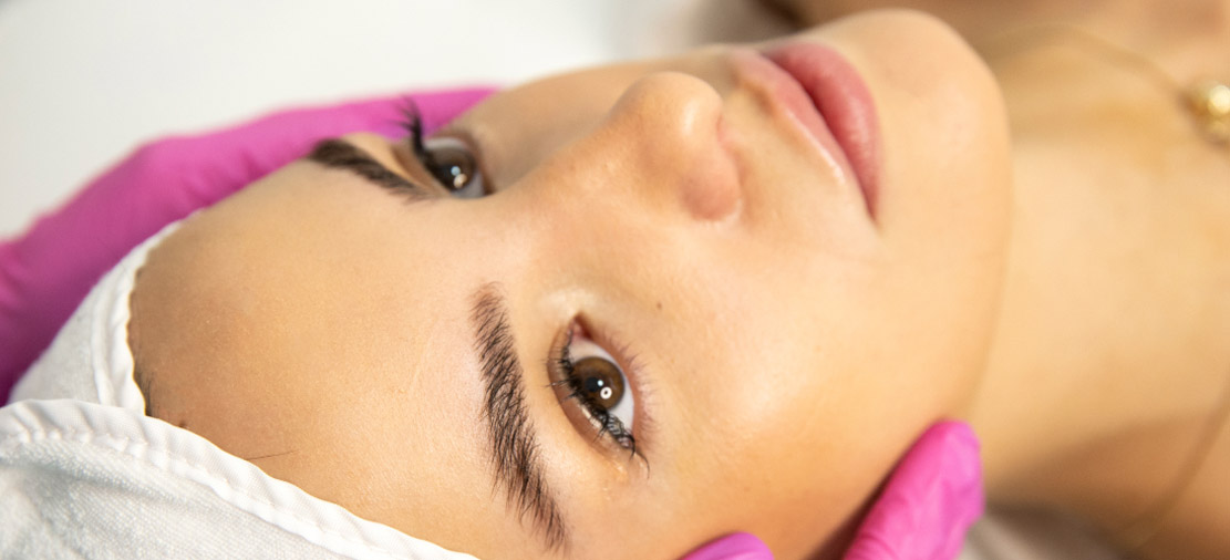 lice pacijentkinje pre Jalupro tretmana