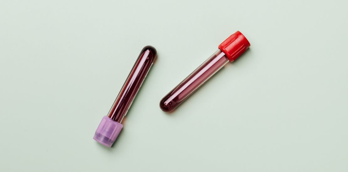 Blood sample for PRP treatment.