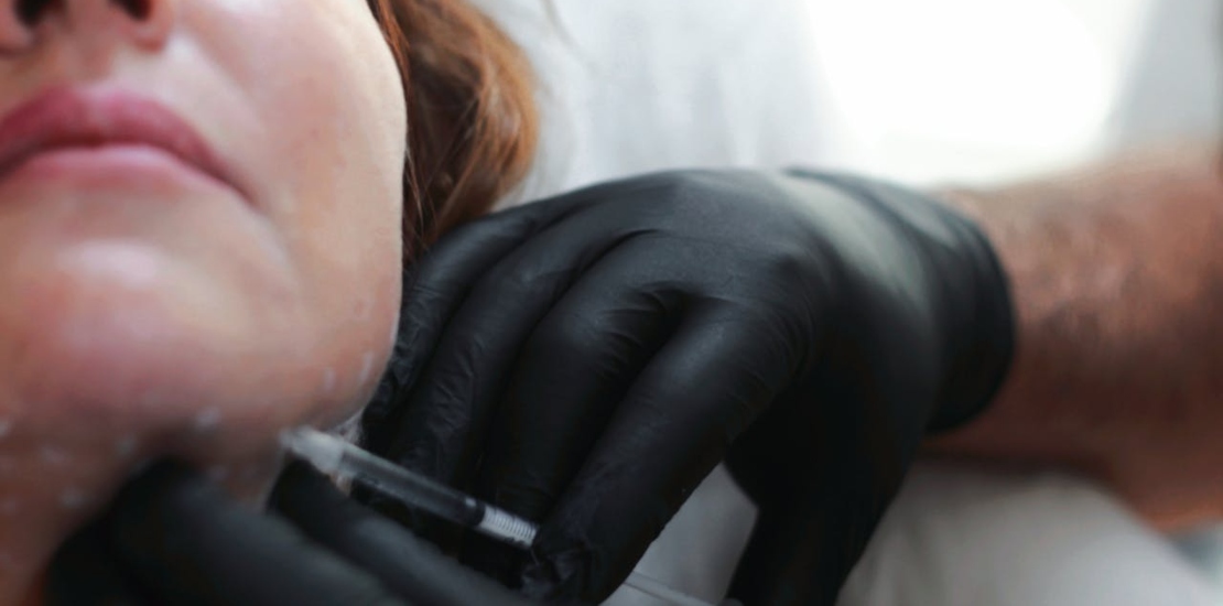 doktor ubrizgava filer pacijentkinji u bradu