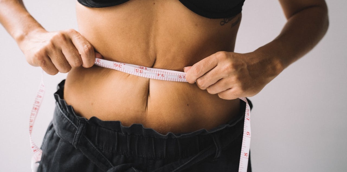 žena spremna za zatezanje kože tela nakon mršavljenja