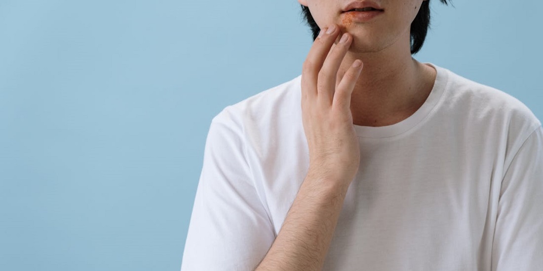 mladi čovek sa Iritacijom kože usled loše kombinacije proizvoda