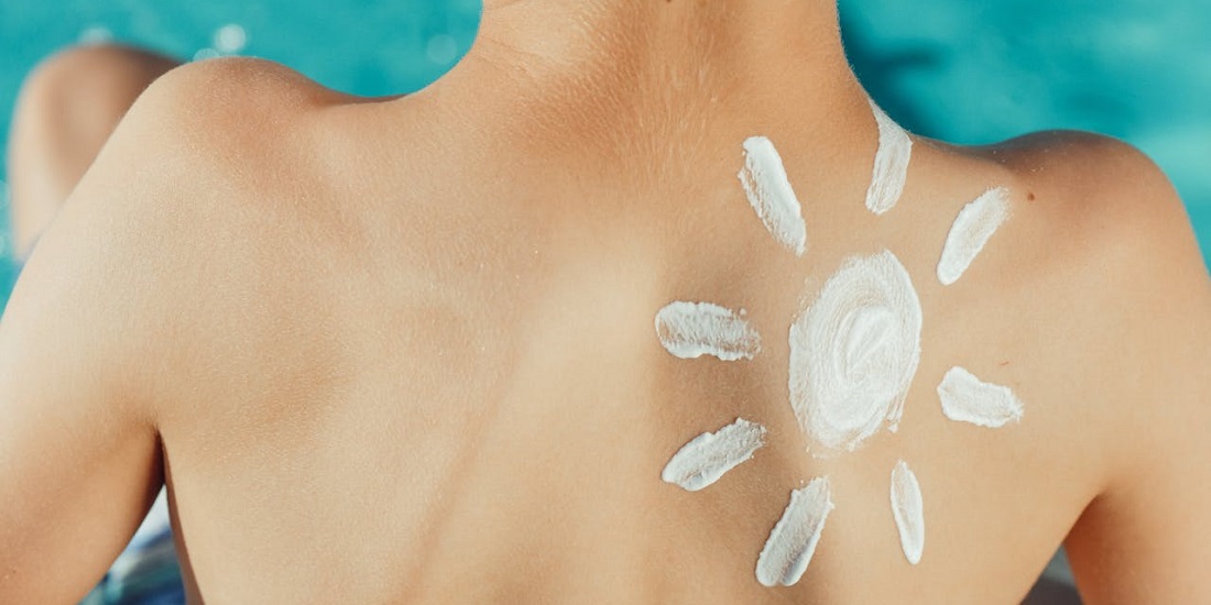 Naslikano sunce od SPF kreme na leđima.
