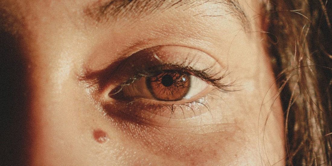 Krupan plan oka sa mladežom ispod donjeg kapka