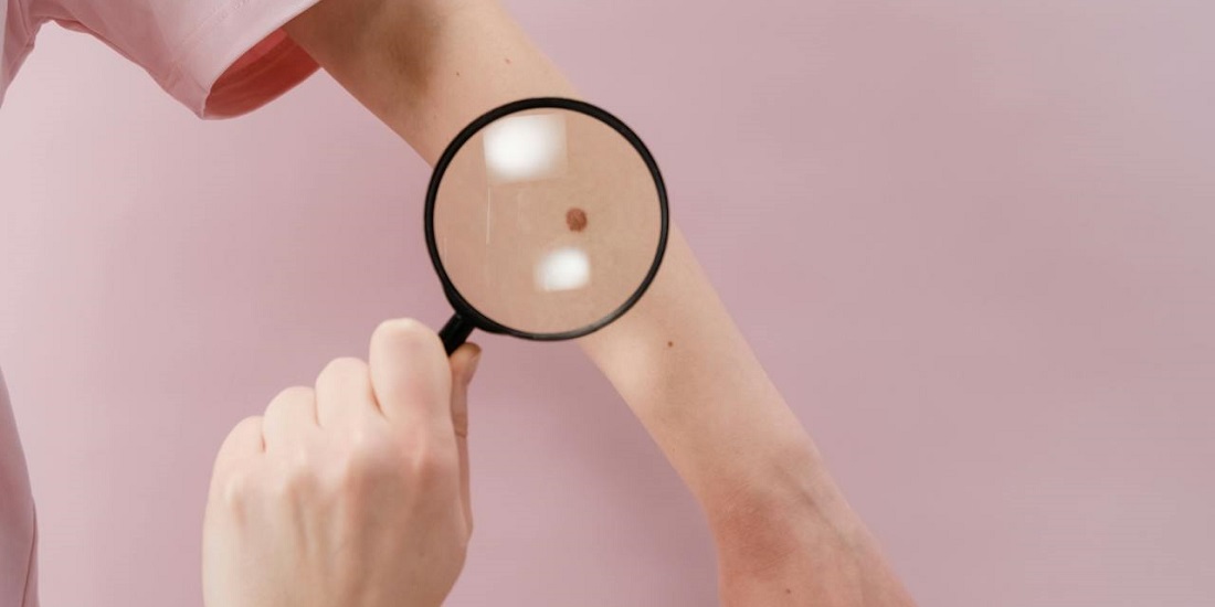 Lupa u fokusu iznad mladeža na podlaktici