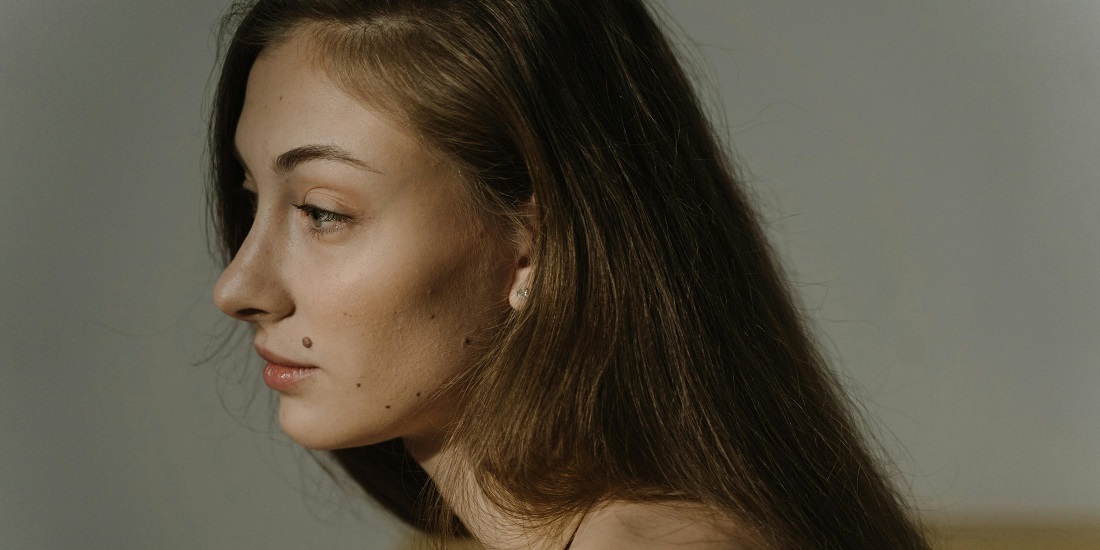 mlada devojka kojoj je potrebno uklanjanje mladeža u ORL regiji