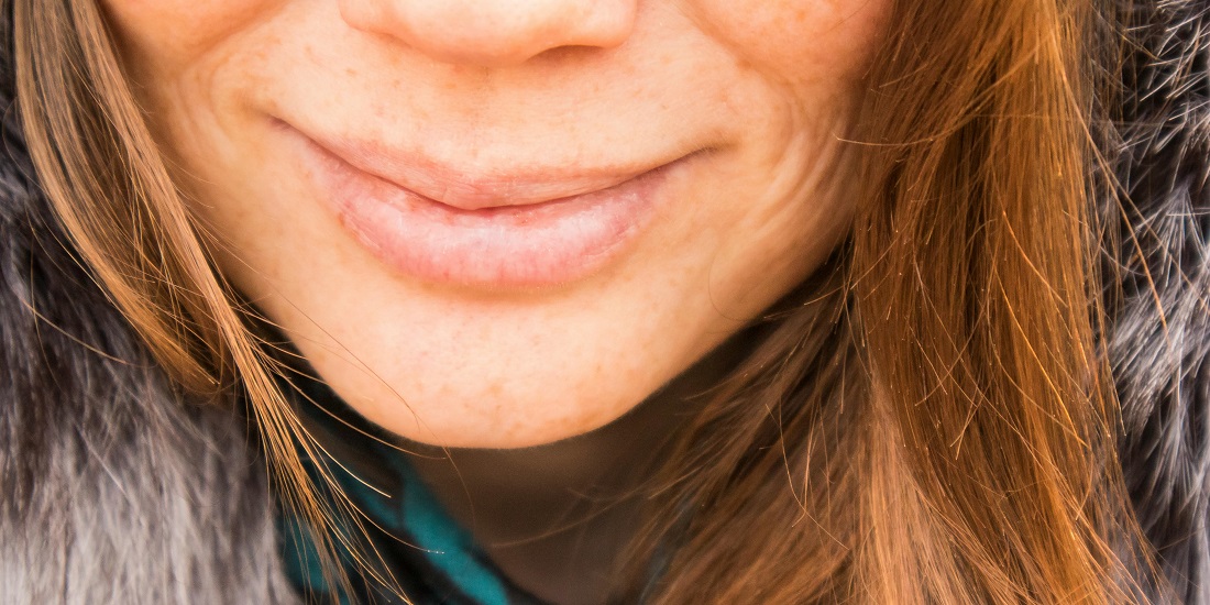 Osmeh žene sa suvim i ispucalim usne tokom hladnog dana.