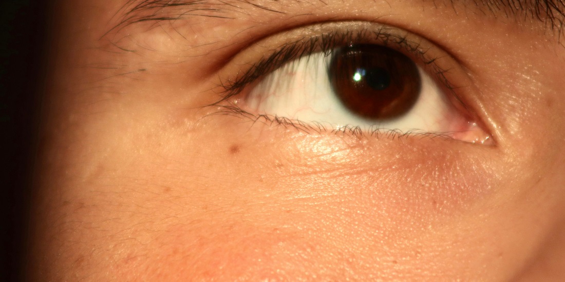 Područje ispod oka sa vidljivim znacima umora i suvoće.