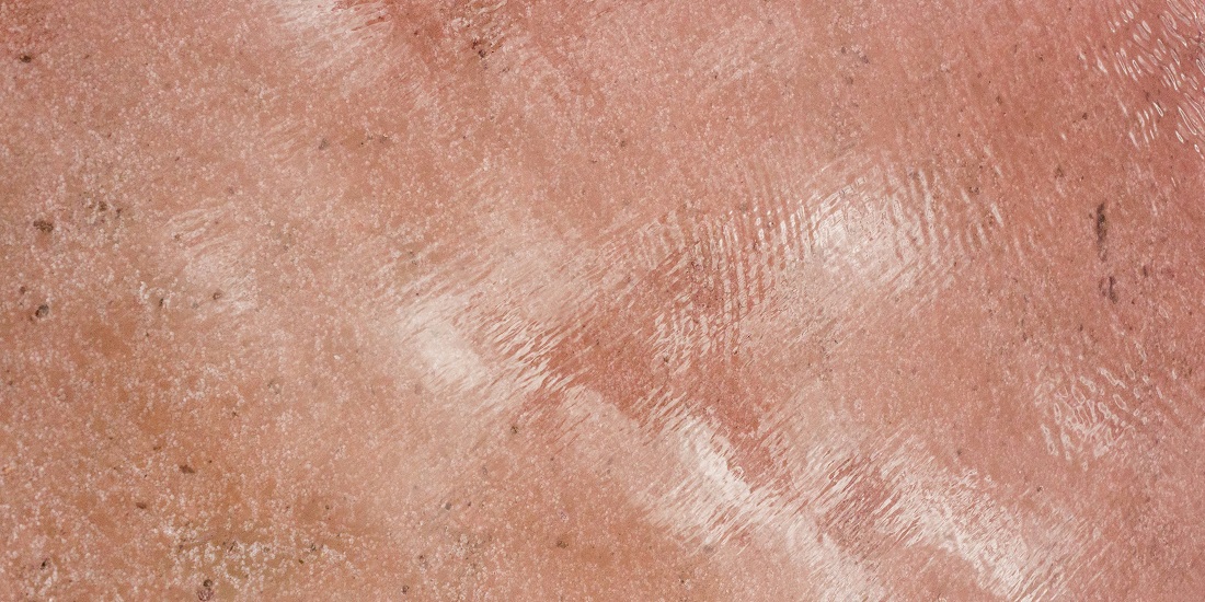 A close-up view of dry skin where you should treat dry eczema on the skin