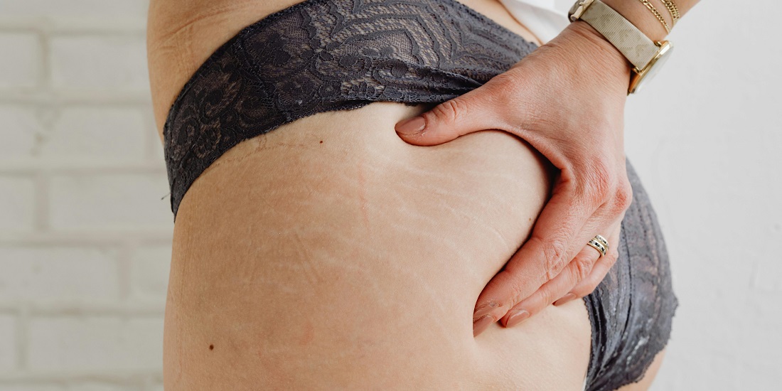 A woman is holding her hip.