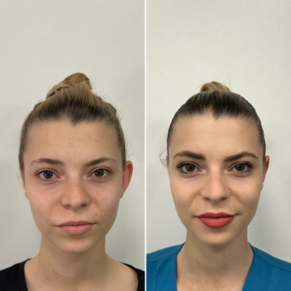 before and after treatment