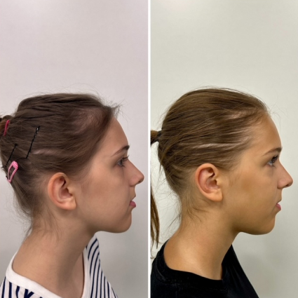 before and after treatment