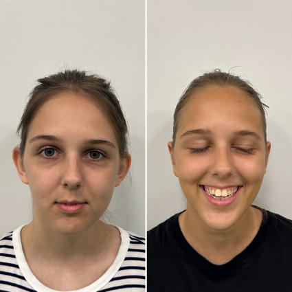 before and after treatment