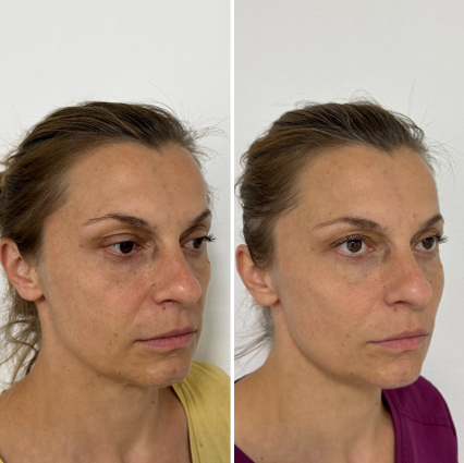 before and after treatment