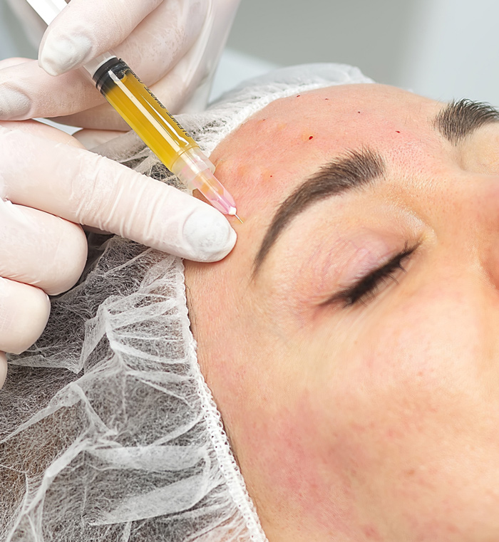 zena radi prp tretman