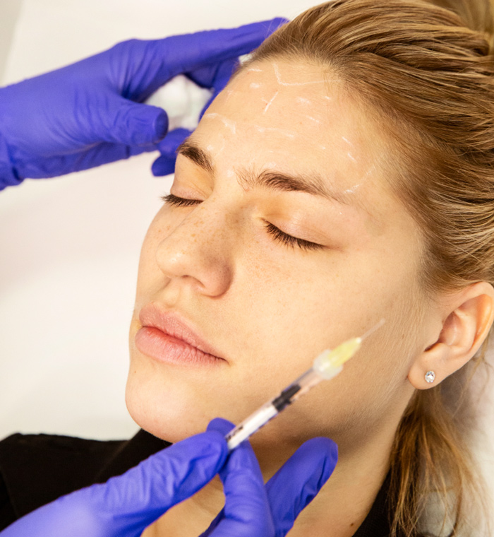 zena radi hijaluronske filere