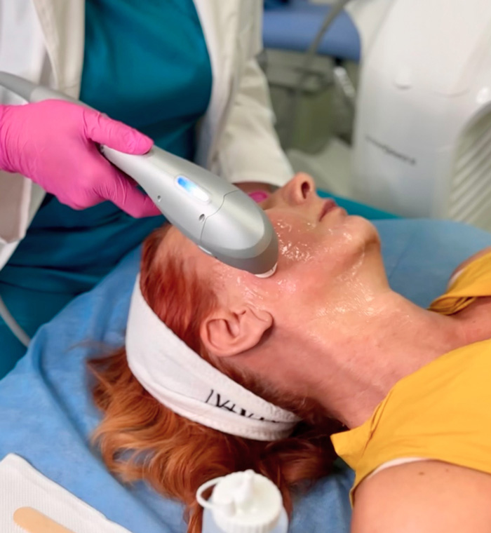 doktorka radi tretman uz ultraformer 3