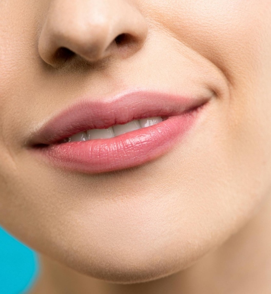 Juvederm fileri u usnama