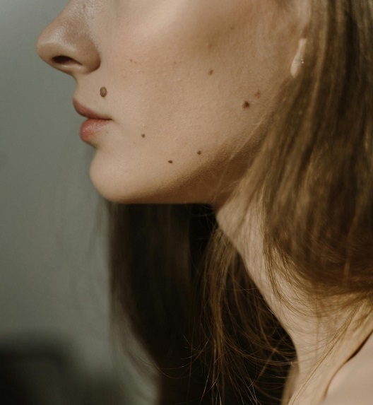 Više mladeža različitih boja duž lica i vrata