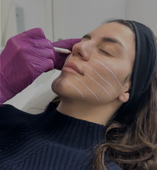 doktorka priprema lice mlade žene pre estetskog zahvata