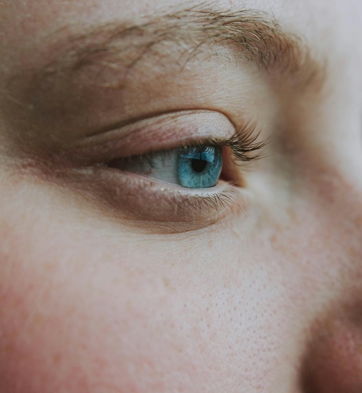 Close-up view of skin with enlarged pores
