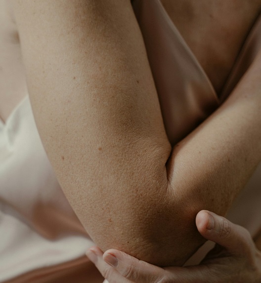 A close-up view of dry skin where dry eczema on the skin should be treated.